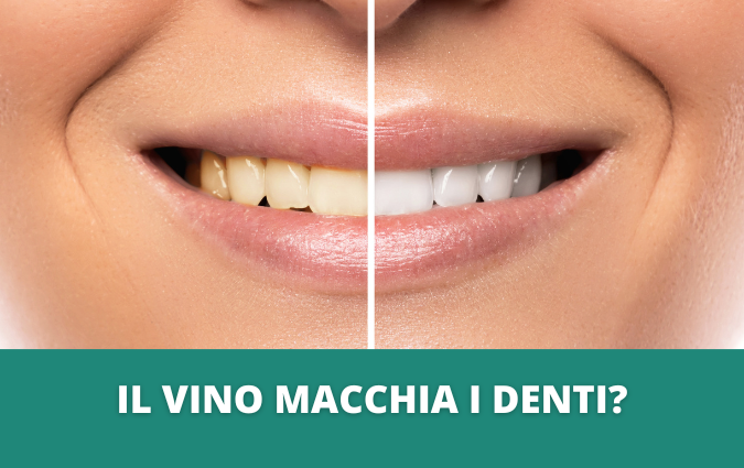 vino denti