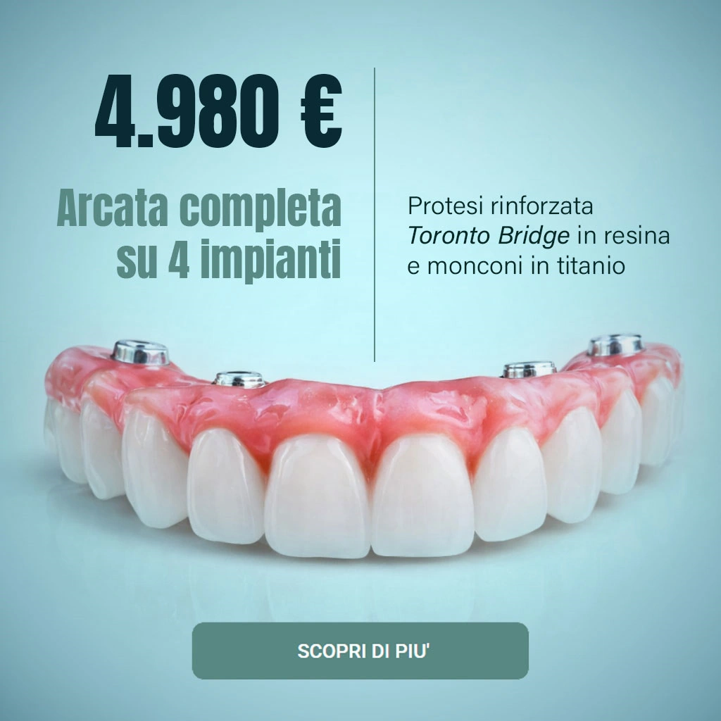 arcata completa su 4 impianti toronto bridge