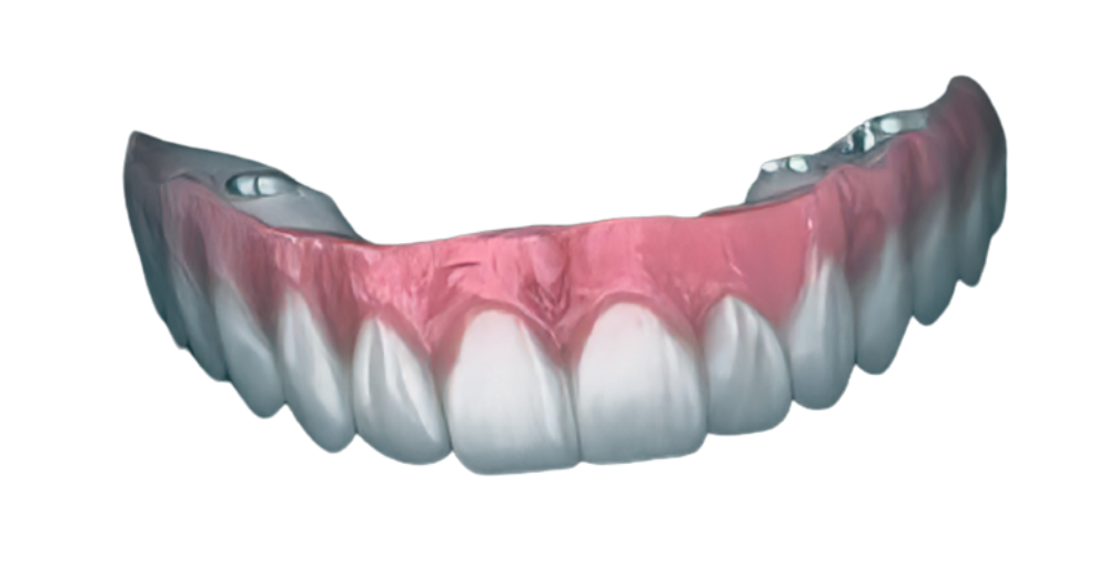 arcata cover e1769684449226